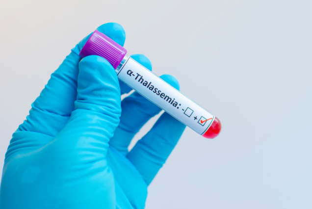 Best Thalassemia Treatment Hospital in India